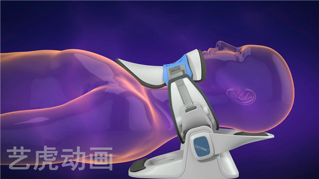 醫學動畫視頻制作 醫學動畫視頻制作