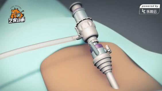 三維醫(yī)學(xué)動畫宣傳片制作 三維醫(yī)學(xué)動畫宣傳片制作